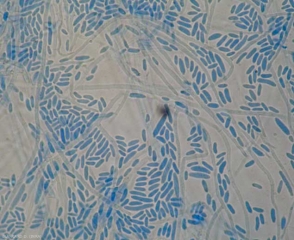 Aparência do micélio e conídios de <b><i>Verticillium dahliae</i></b> (verticilliose, <i>Verticillium</i> wilt).