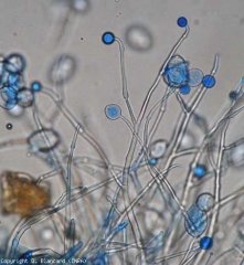 Vários esporangiofóforos jovens com protuberâncias estão a desenvolver-se. <b><i>Phytophthora infestans</i></b> (mildiou)